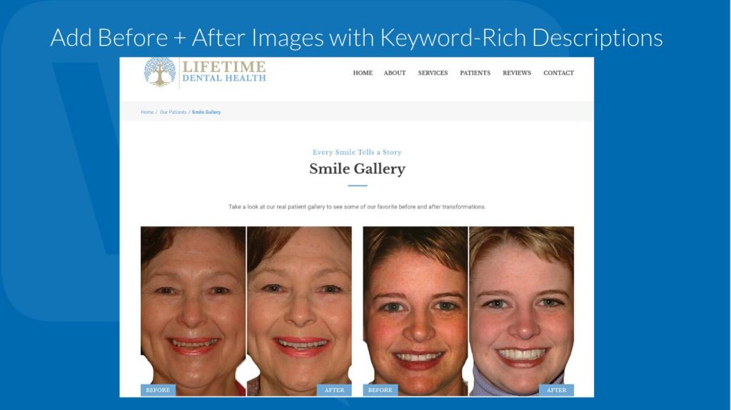 Before and After Images with Keyword-Rich Descriptions